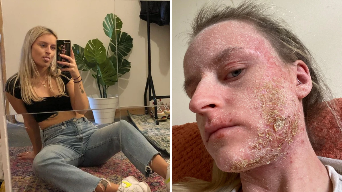 ‘LIVING HELL’: Woman’s face COVERED with excruciating lizard-like skin
