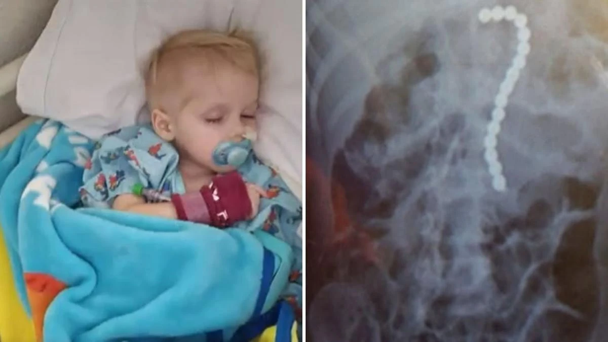Family’s devastating blow after horror find in toddler’s X-ray