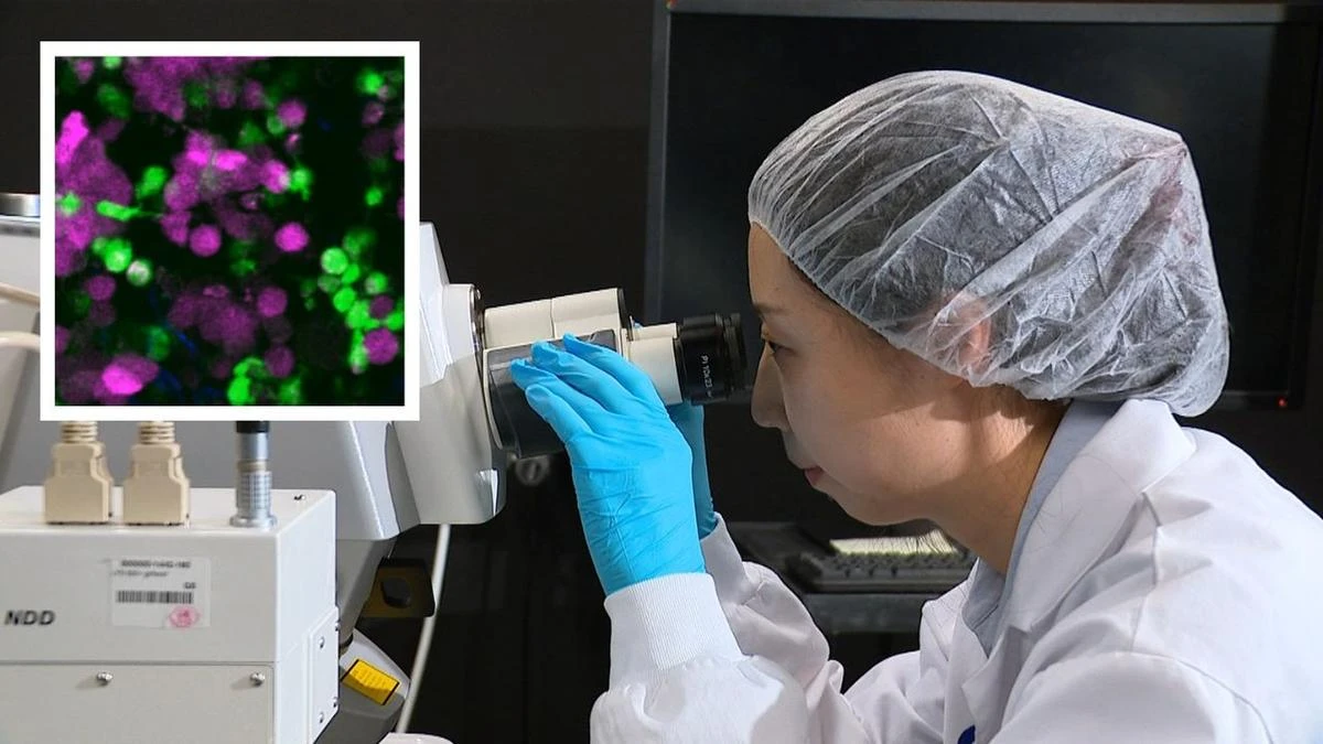 Major cancer breakthrough as immune cells captured devouring live melanoma