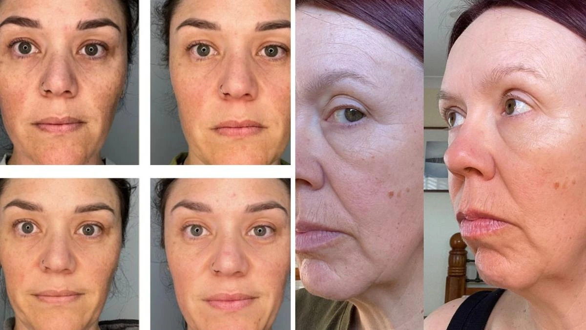 Meet the eye serum that can ‘reduce wrinkles by 194 per cent’