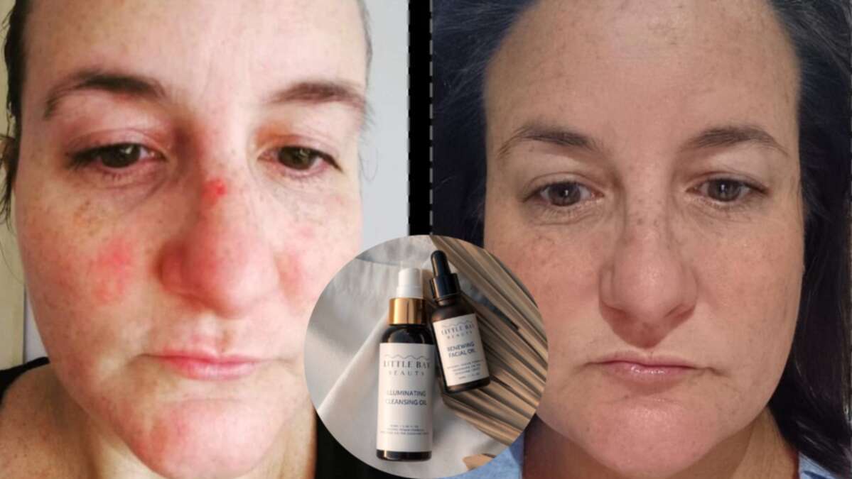 This skincare duo that sold out in a week is currently 25% off