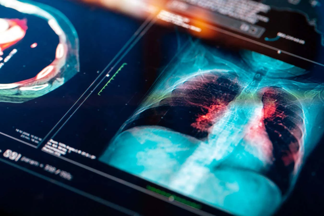 AI doesn't know 'no' – and that's a huge problem for medical bots