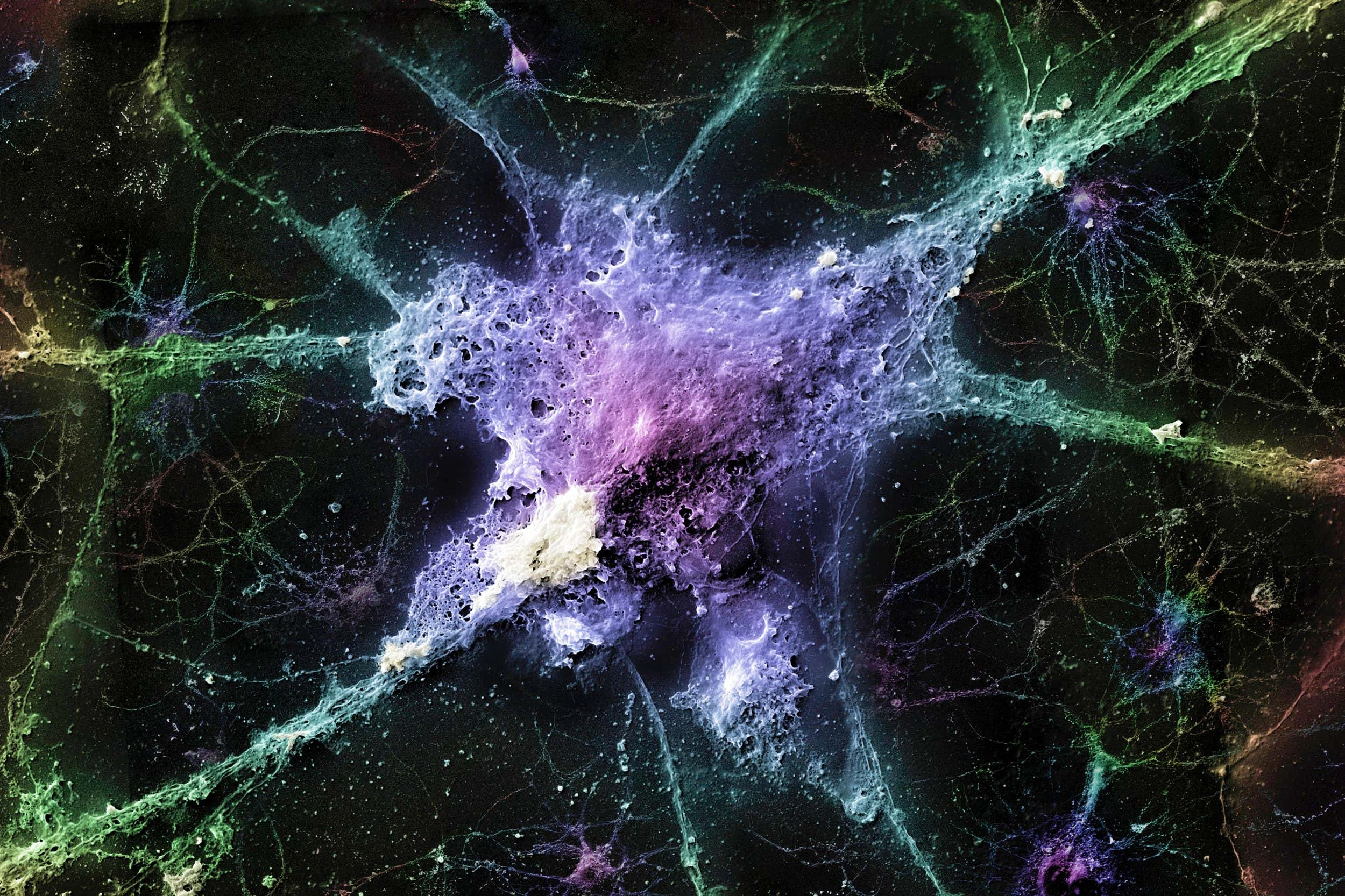 Novel approach to clearing brain waste shows promise for Alzheimer's