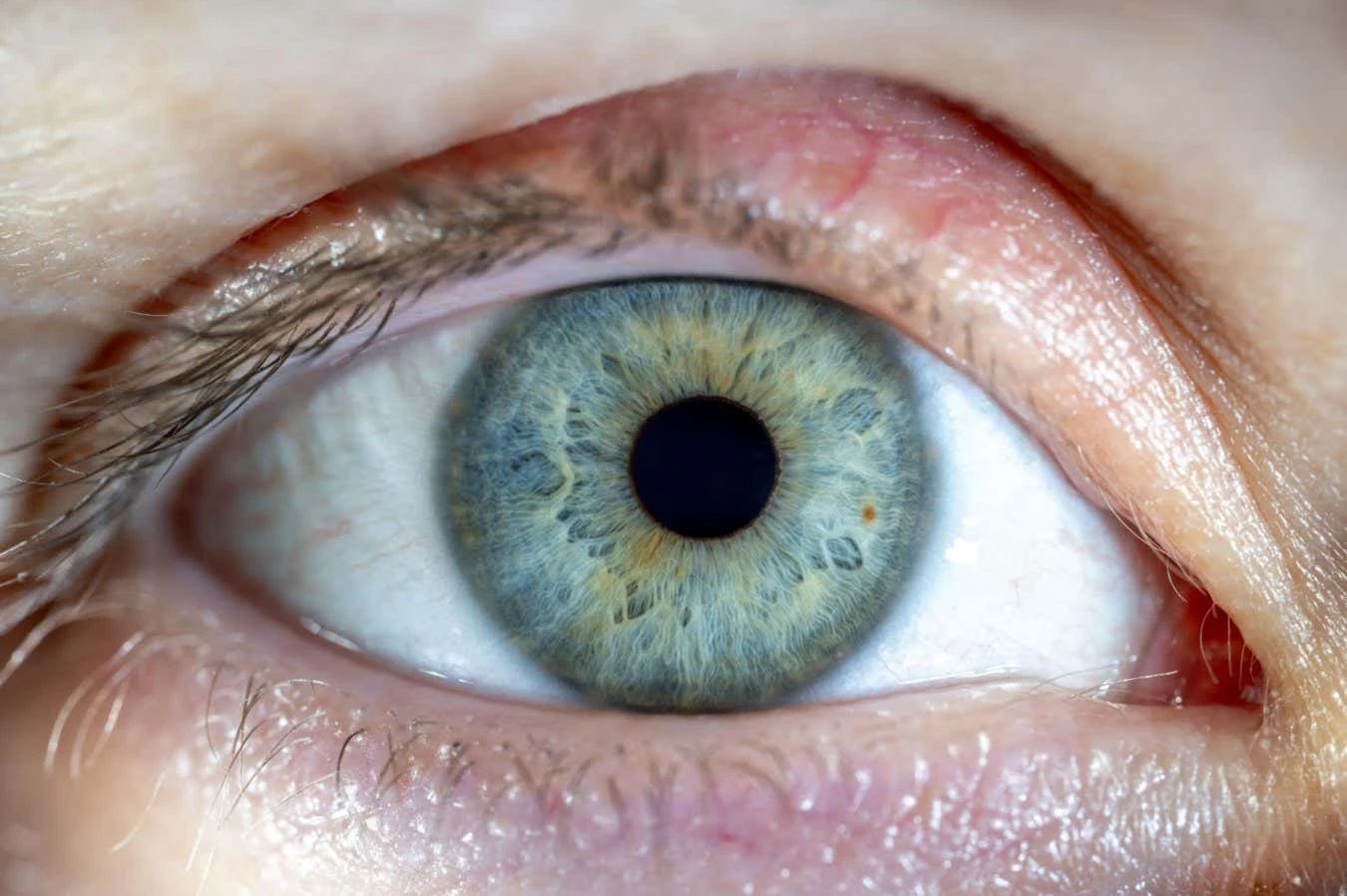 Resuscitated human retinas respond to light 10 hours after death