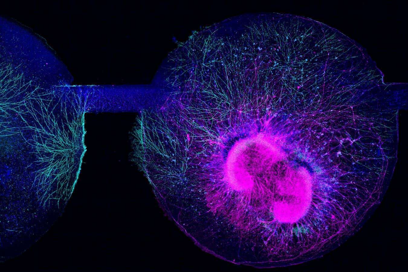 Mini-brains have been fused to resemble that of a 40-day-old fetus