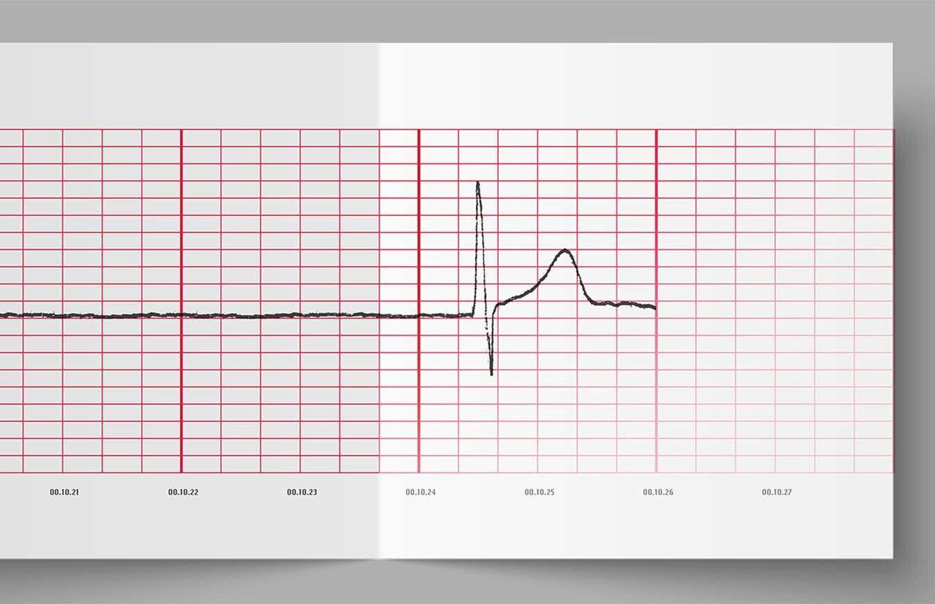 The radical treatments bringing people back from the brink of death