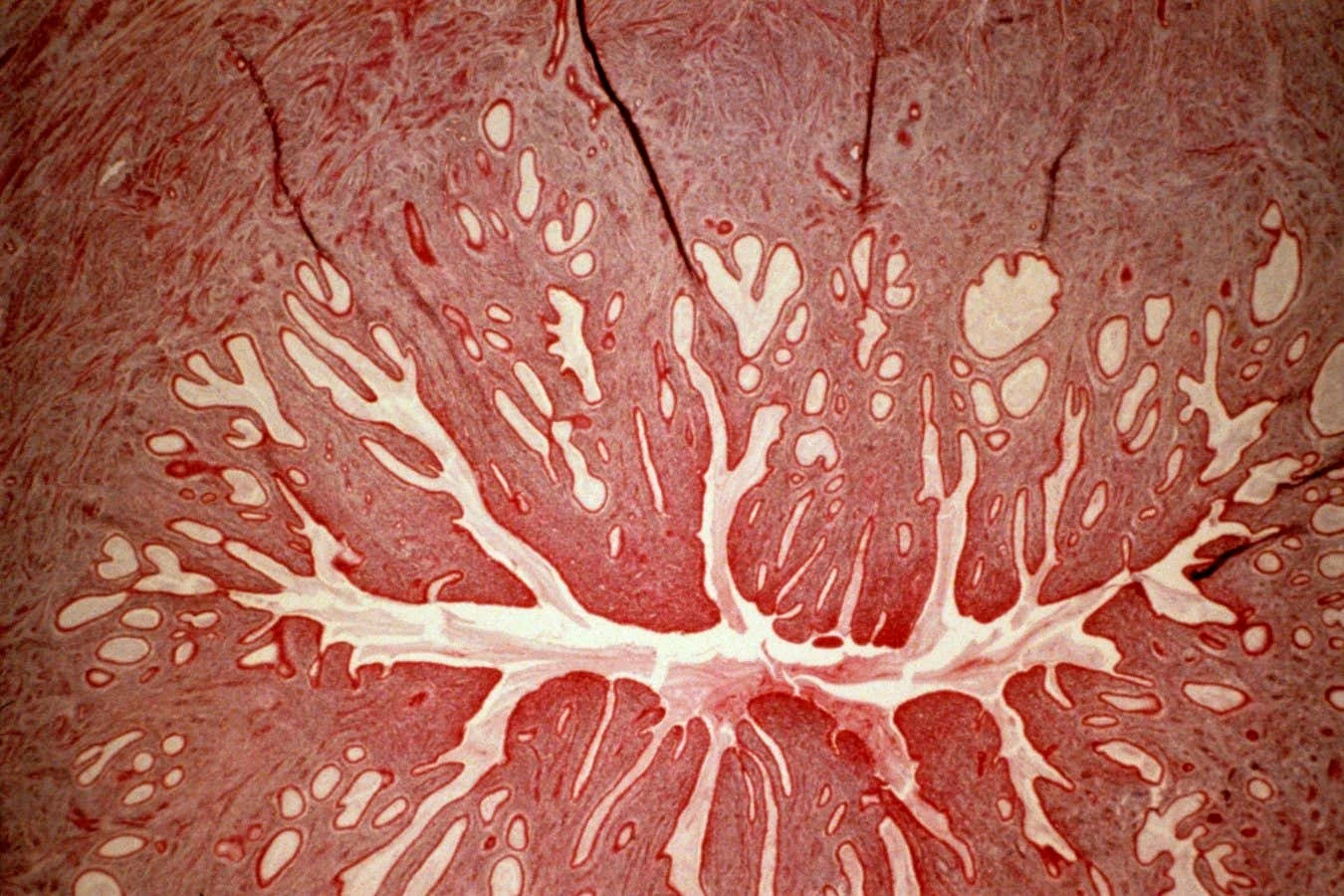 Cervix-on-a-chip inspires potential new treatment for preterm birth
