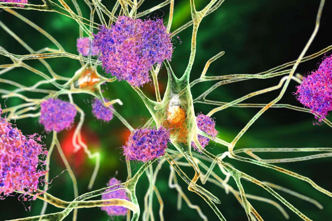 Low dose of lithium reverses Alzheimer's symptoms in mice