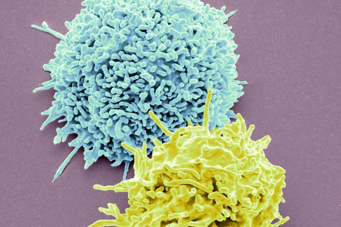 Inside the new therapies promising to finally beat autoimmune disease