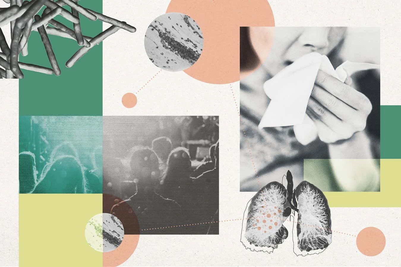 TB's extraordinary evolution reveals why the ancient disease lives on