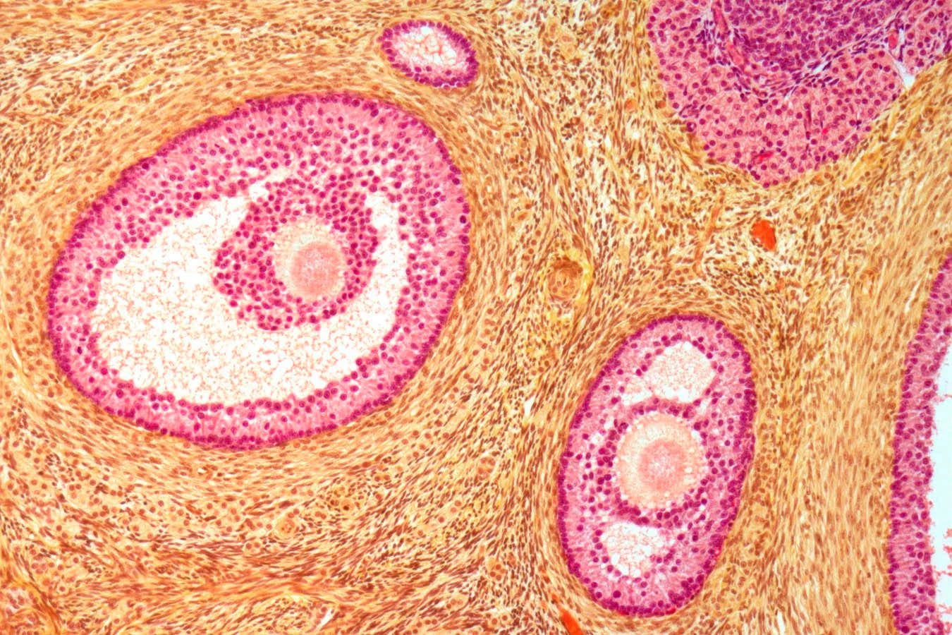 Our fertility window could be extended by making ovaries softer