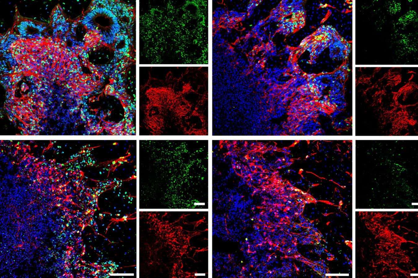 Frozen human brain tissue can now be revived without damage