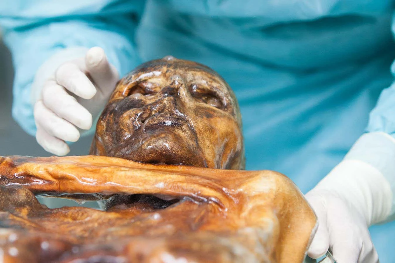 Ötzi's frozen remains may harbour metabolically active microbes