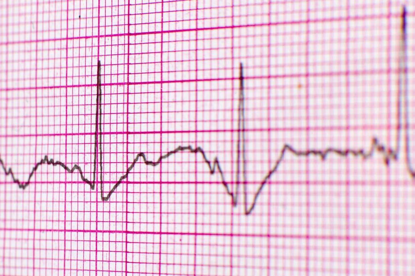 Quantum diamond sensor measured heart signals from a living rat