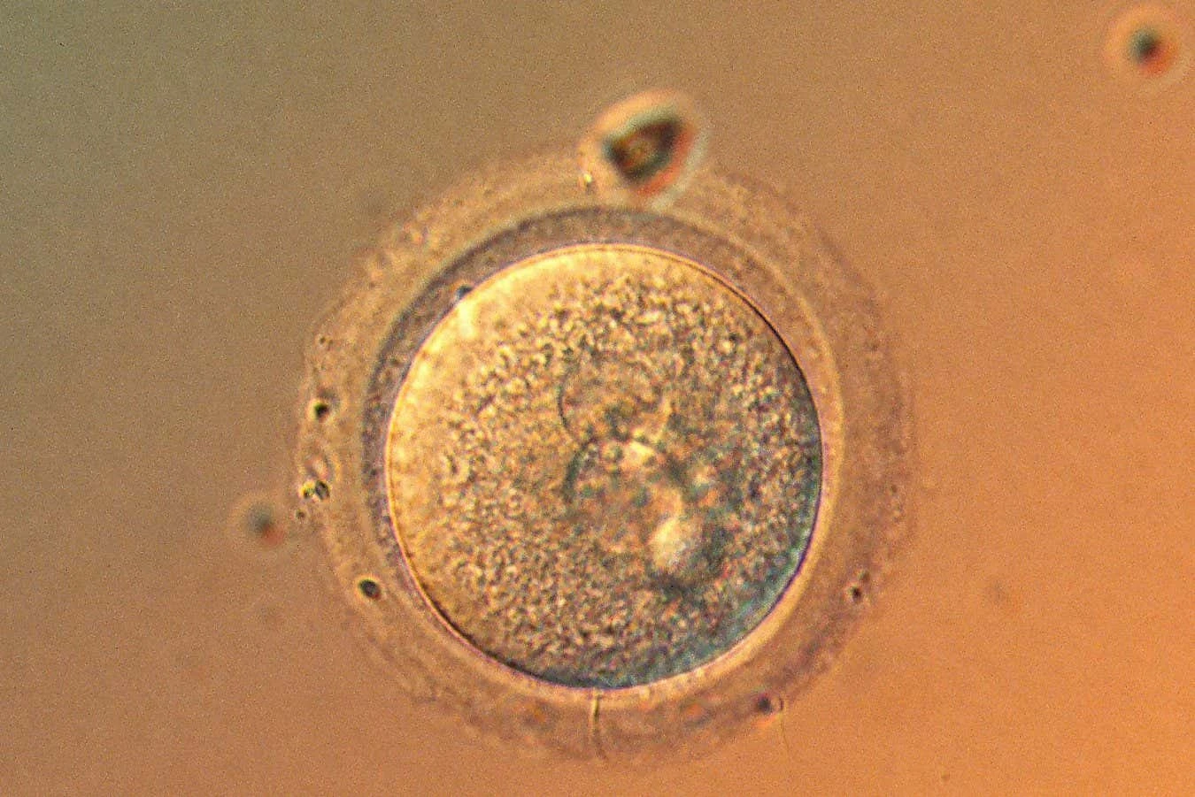 Are we getting to the point where it's safe to gene-edit babies?