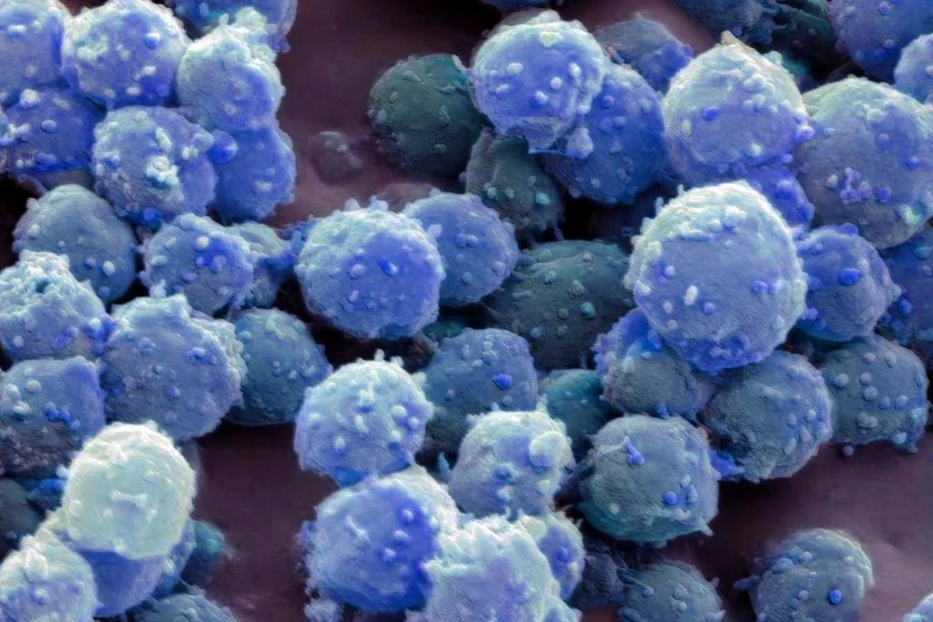 We are unlocking how frozen microbes stay alive for 100,000 years