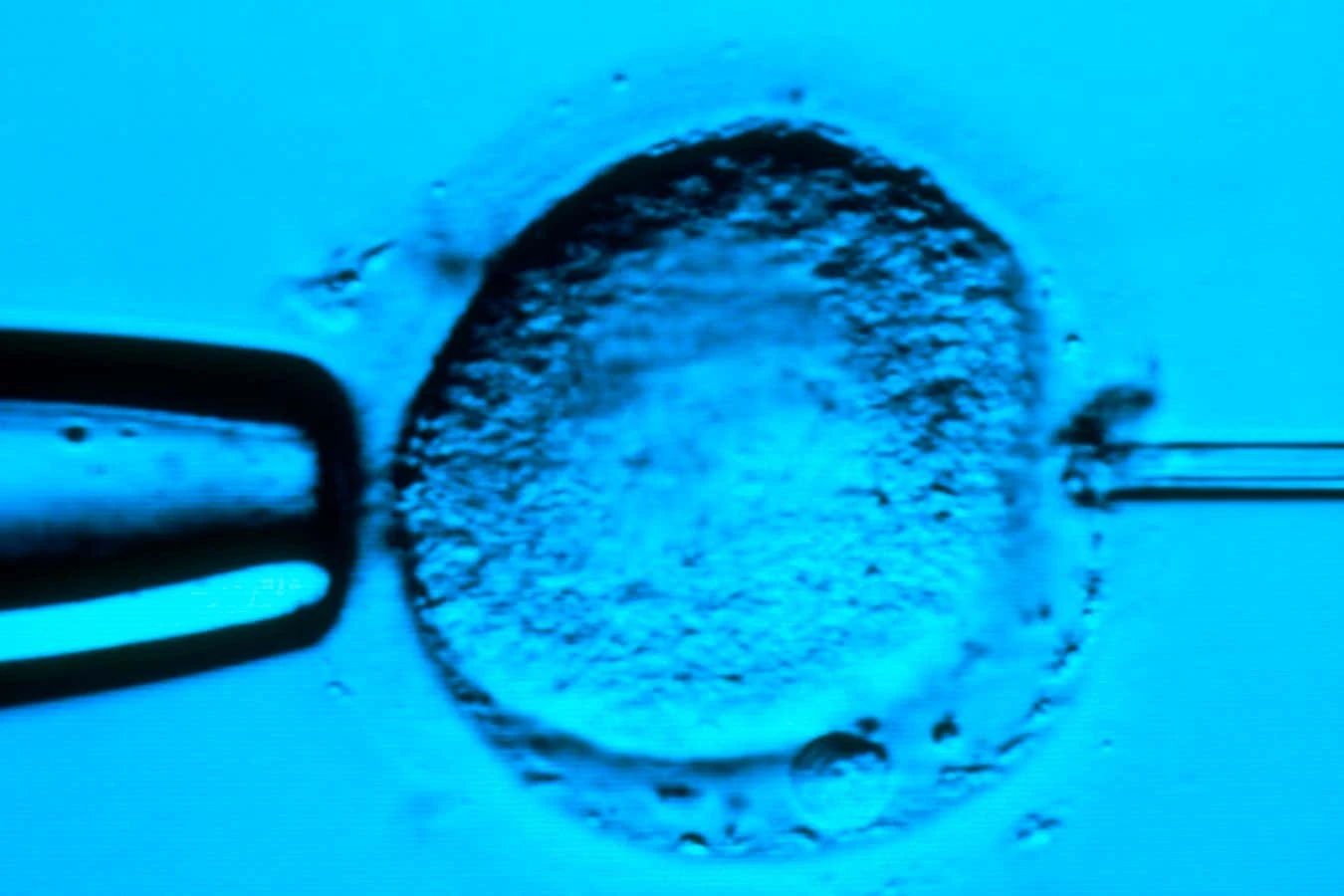 We’ve uncovered a master gene that switches on human development