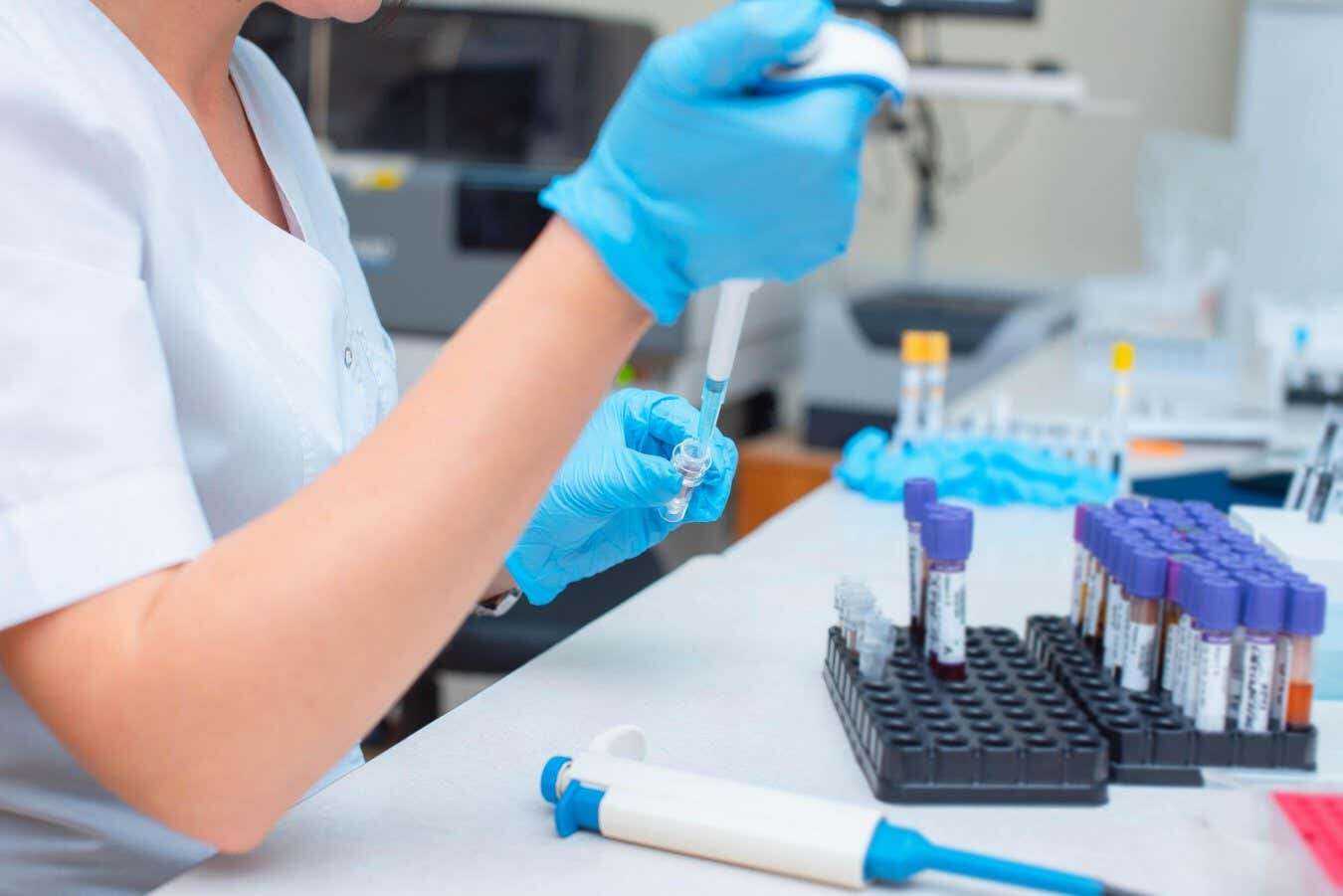 Blood test could diagnose ALS with up to 97 per cent accuracy