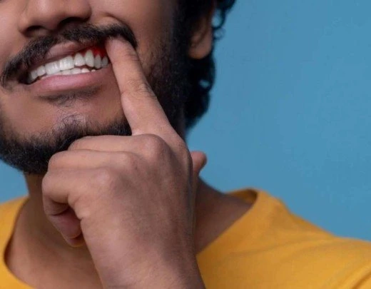 Cinco sinais de problemas na gengiva que nÃ£o podem ser ignorados