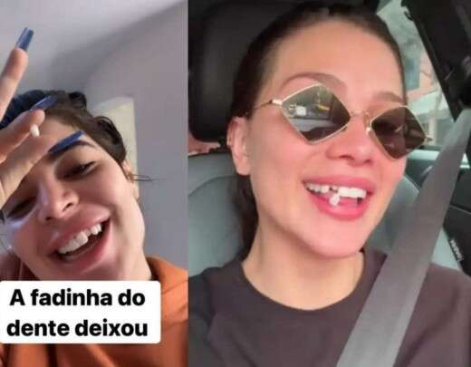 Relembre os famosos que tiveram problemas com as lentes de contato dentais