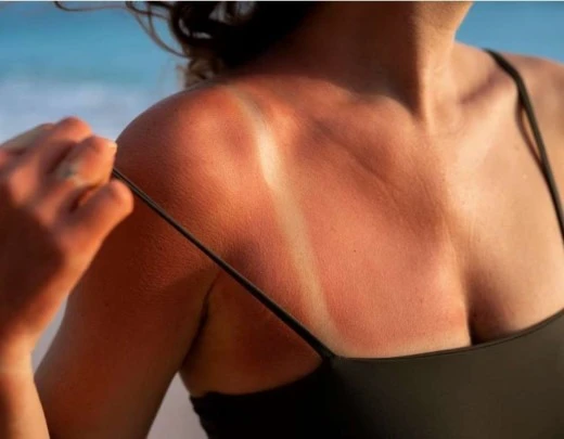 Autobronzeador, pÃ­lulas, Ã³leo... o que pode ou nÃ£o ser usado para manter o bronzeado?
