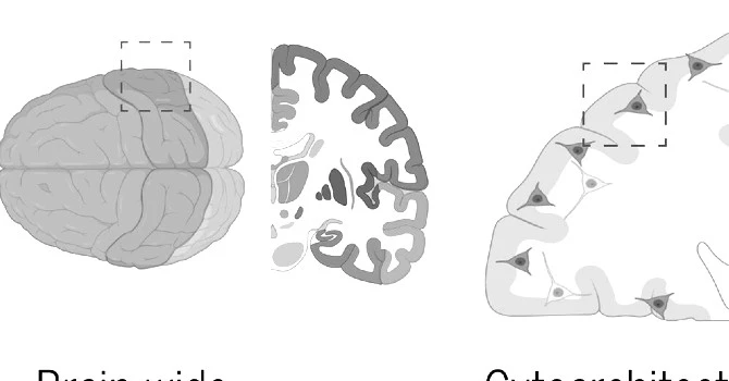 Una nuova finestra sul cervello. La risoluzione è senza precedenti. #imaging