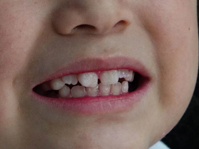 ¡Histórico avance! Científicos logran cultivar dientes humanos en laboratorio