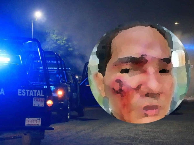 Joven denuncia golpiza por parte de personal de seguridad de un centro nocturno en SLP