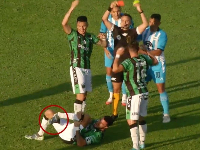VIDEO: Stefano Callegari sufre espeluznante fractura