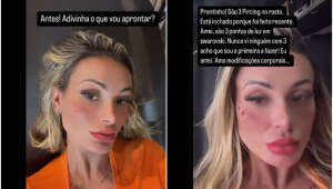 Andressa Urach adiciona piercings e tatuagem de sardas em nova transformação estética