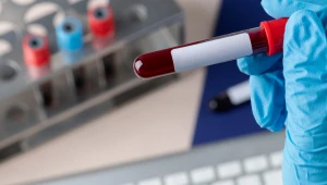 Exames de sangue revolucionam o diagnóstico precoce de doenças complexas