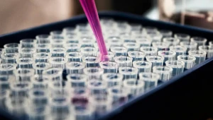 Exame de sangue promete transformar diagnóstico do Alzheimer, mas não é para todos