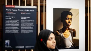 Foto de menino palestino que perdeu os dois braços em ataque de Israel ganha o World Press Photo de 2025