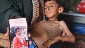 Um terço das crianças em Gaza estão gravemente desnutridas e não sobreviverão, diz ONU