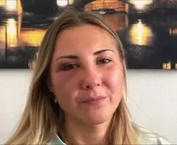 22-latka uderzona w twarz na ulicy. Powód? Spódnica. Burza we Francji