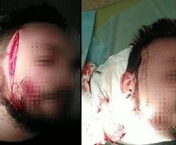 Horror w Gdyni. Pijany mężczyzna zaatakował nożem protestującego