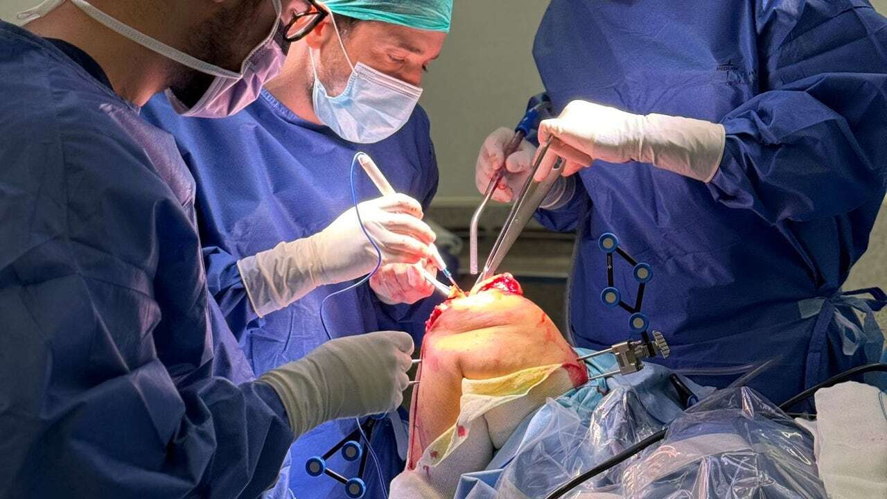 El Hospital Universitario del Vinalopó entre los top de España al implantar prótesis de rodilla con cirugía robótica