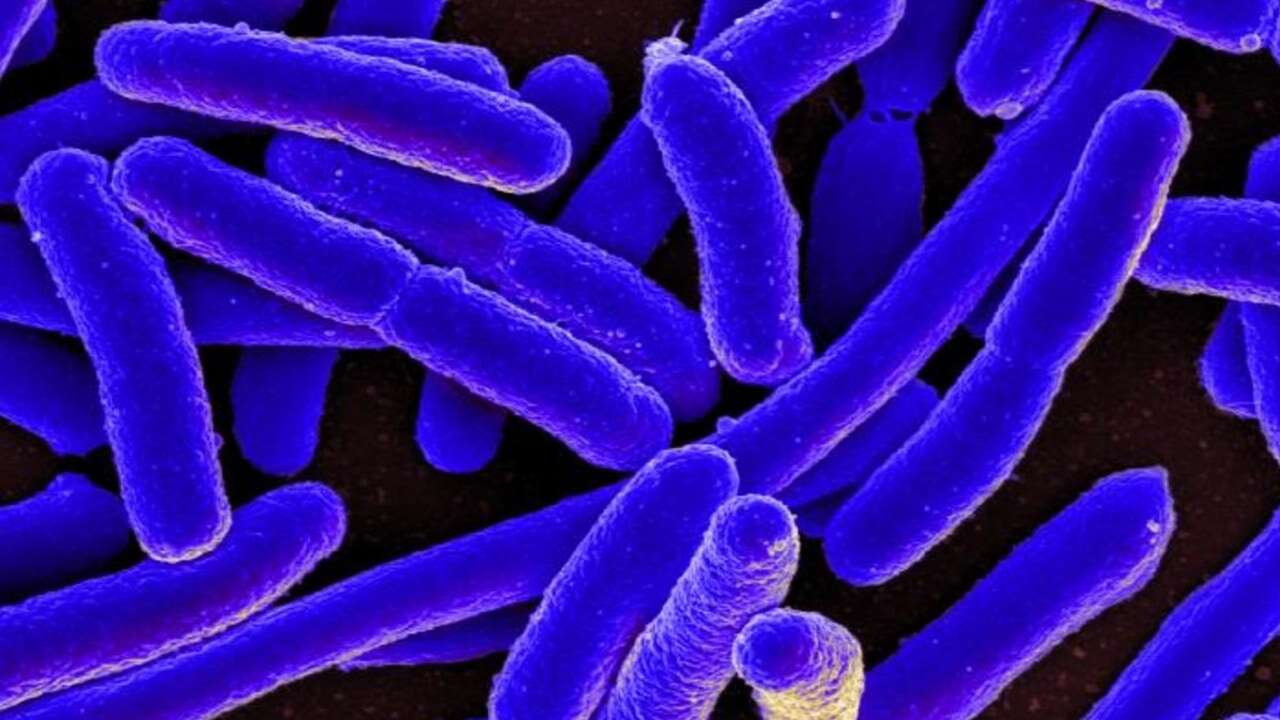 ¿Qué es la bacteria E. Coli transmitida por los quesos que Consumo ha ordenado retirar y cómo evitar la infección?