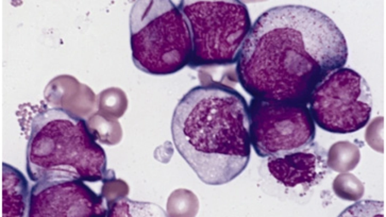 Llaga a España un medicamento innovador para el cáncer infantil más frecuente