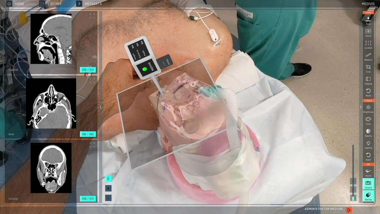 Esta tecnología permite ver el interior del cuerpo humano en directo