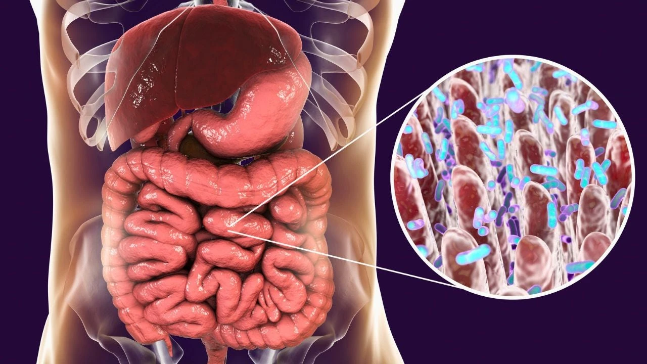 Cáncer de estómago: el 76% de los casos estarán relacionados con una infección común que se puede prevenir