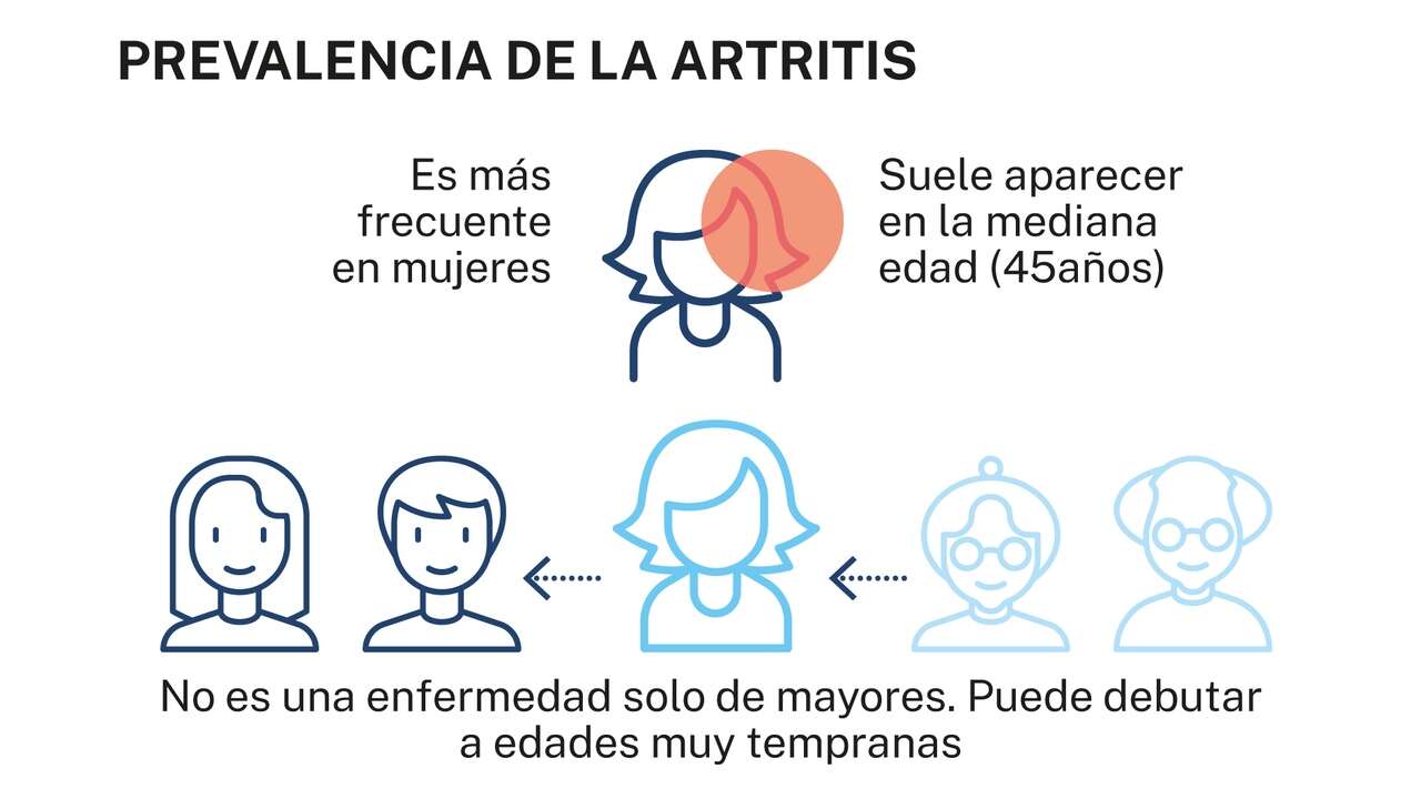 Más esperanzas para la artritis reumatoide con un diagnóstico precoz y tratamiento individualizado