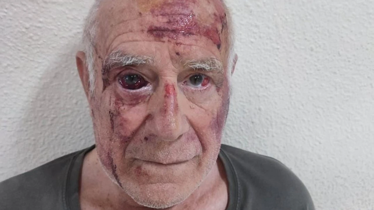 No fue un robo, fue diversión: la escalofriante agresión a un anciano de 70 años en Murcia
