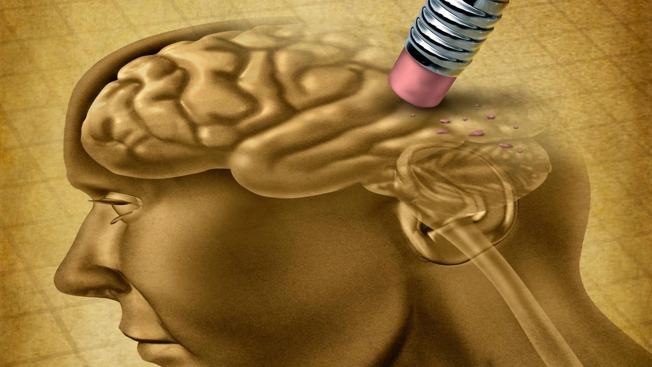 Esto es lo primero que olvida una persona con Alzheimer