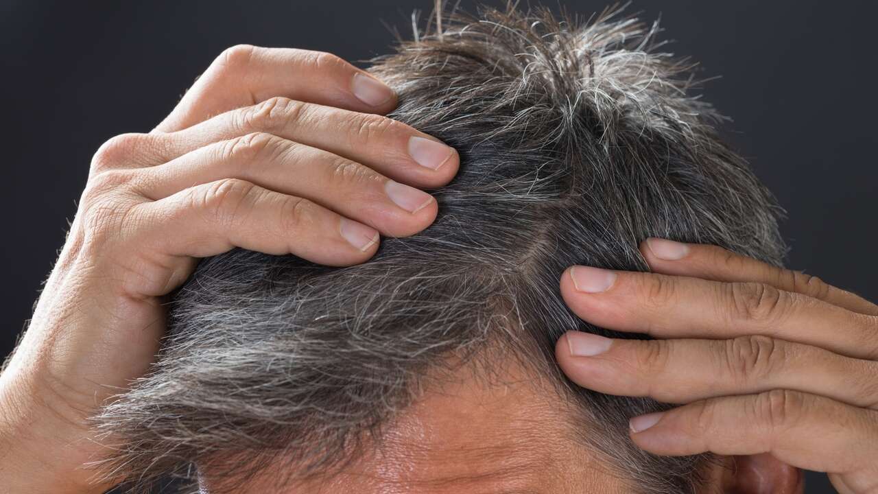 Adiós a las canas: este alimento permite retrasar el envejecimiento y mantener un aspecto joven siempre