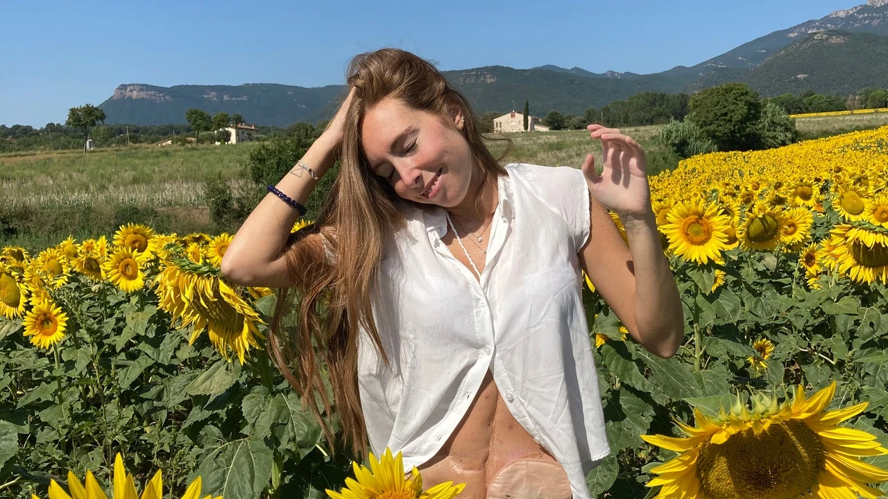 Tanit Tubau: «La bolsa y las cicatrices por mi enfermedad de Crohn reflejan que estoy viva gracias a la investigación»