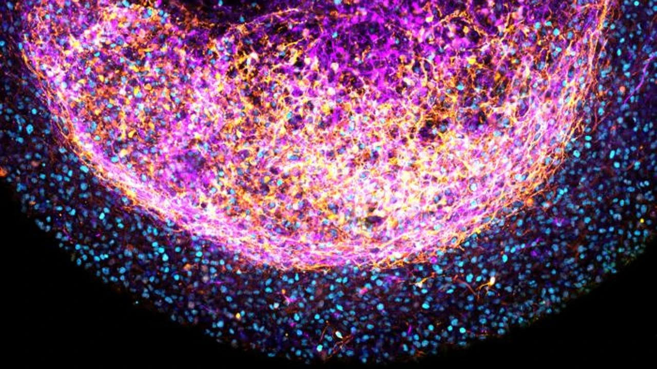 Cerebro: lo que has olvidado, aún influye en tus decisiones
