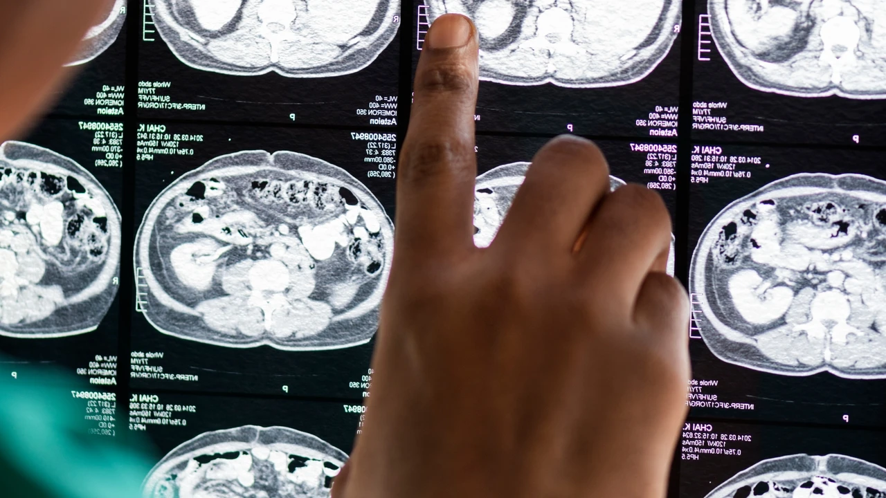 Investigadores apuntan al litio como clave en la prevención y tratamiento del Alzheimer