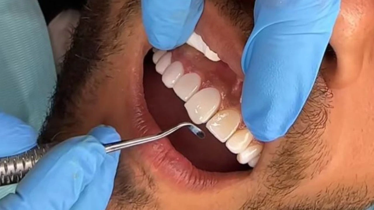 ¿Una sonrisa perfecta por 1.250 euros? Dentistas advierten de los peligros del turismo dental en Marruecos