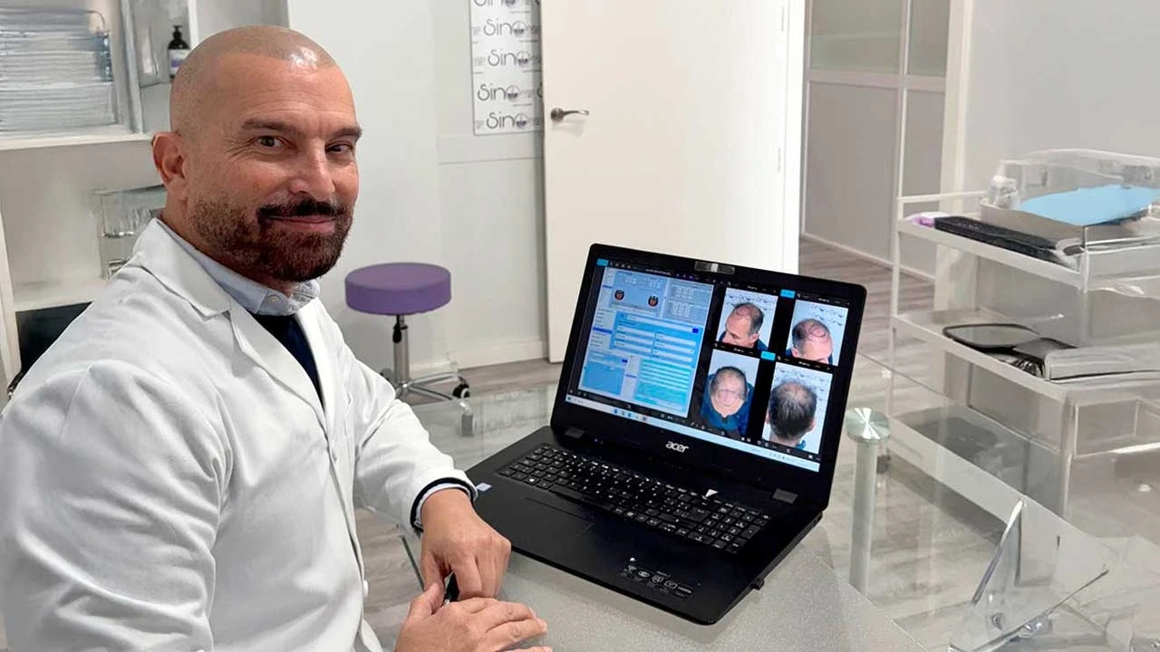 “La inteligencia artificial ha elevado el trasplante capilar a un nivel de precisión nunca visto”